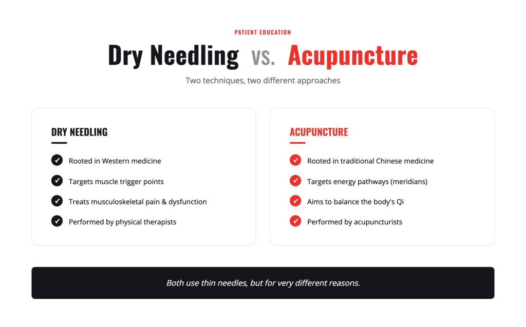 Comparison infographic of dry needling versus acupuncture. Dry needling is rooted in Western medicine, targets muscle trigger points, treats musculoskeletal pain and dysfunction, and is performed by physical therapists. Acupuncture is rooted in traditional Chinese medicine, targets energy pathways called meridians, aims to balance the body's Qi, and is performed by acupuncturists. Both use thin needles, but for different reasons.
