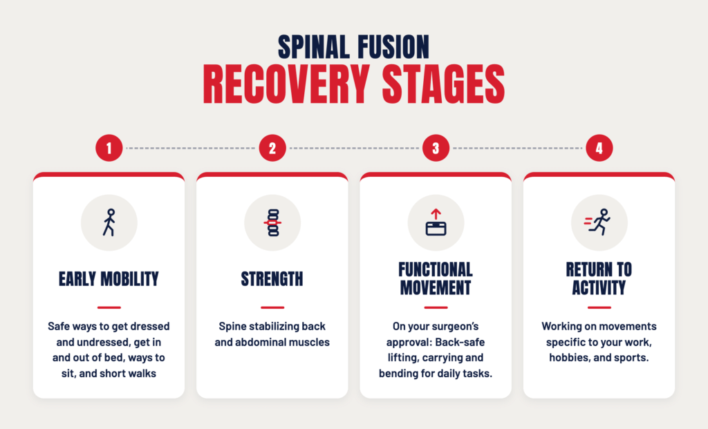 Infographic titled Spinal Fusion Recovery Stages, showing four numbered stages connected by a dotted line. Stage 1, Early Mobility: safe ways to get dressed and undressed, get in and out of bed, sit, and take short walks. Stage 2, Strength: building the back and abdominal muscles that stabilize the spine. Stage 3, Functional Movement: with your surgeon’s approval, back-safe lifting, carrying, and bending for daily tasks. Stage 4, Return to Activity: practicing movements specific to your work, hobbies, and sports.